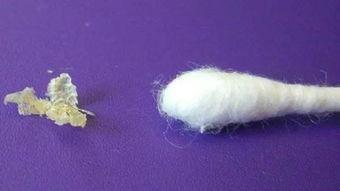 耳屎的图片,形态各异，揭秘人体自洁机制